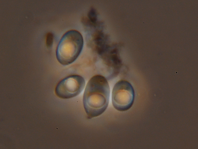 Quale Hyphoderma? (H. praetermissum?)